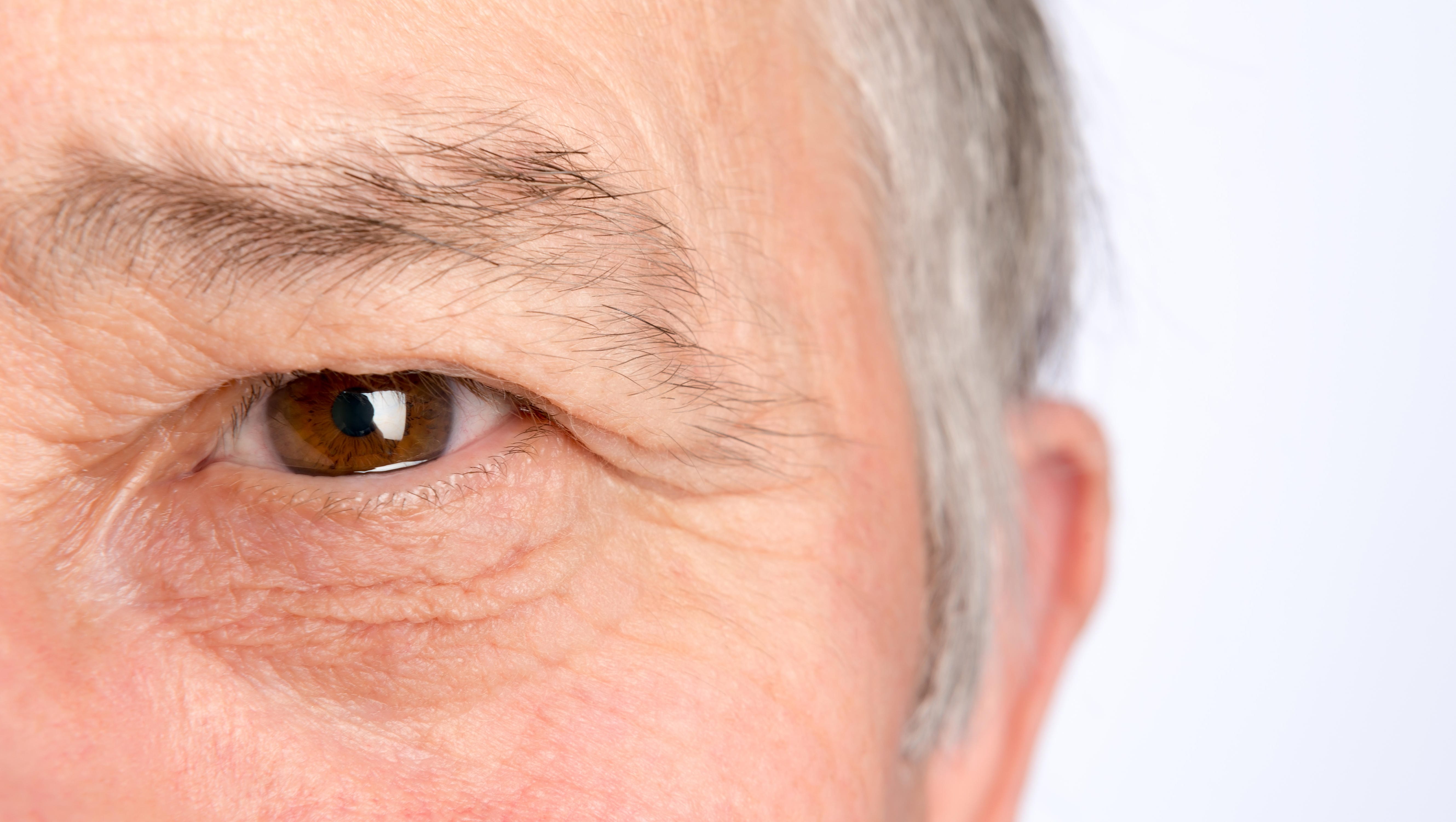 Лечение катаракты у пожилых людей операция. Глаза пожилого мужчины.